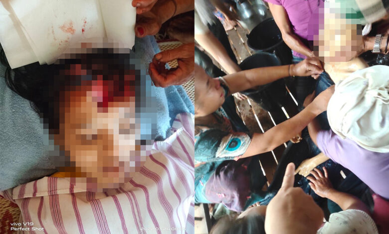Photo of Teenage Girl Killed and Three Others Villagers Seriously Wounded by Burma Army Shelling of Civilian Areas